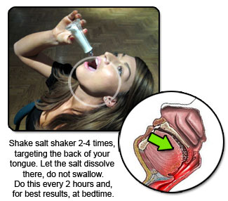 sore throat remedies